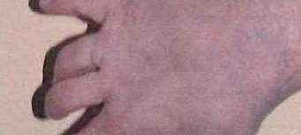 Flüchtiger Mann aus Hamburg könnte sich in Aachen aufhalten