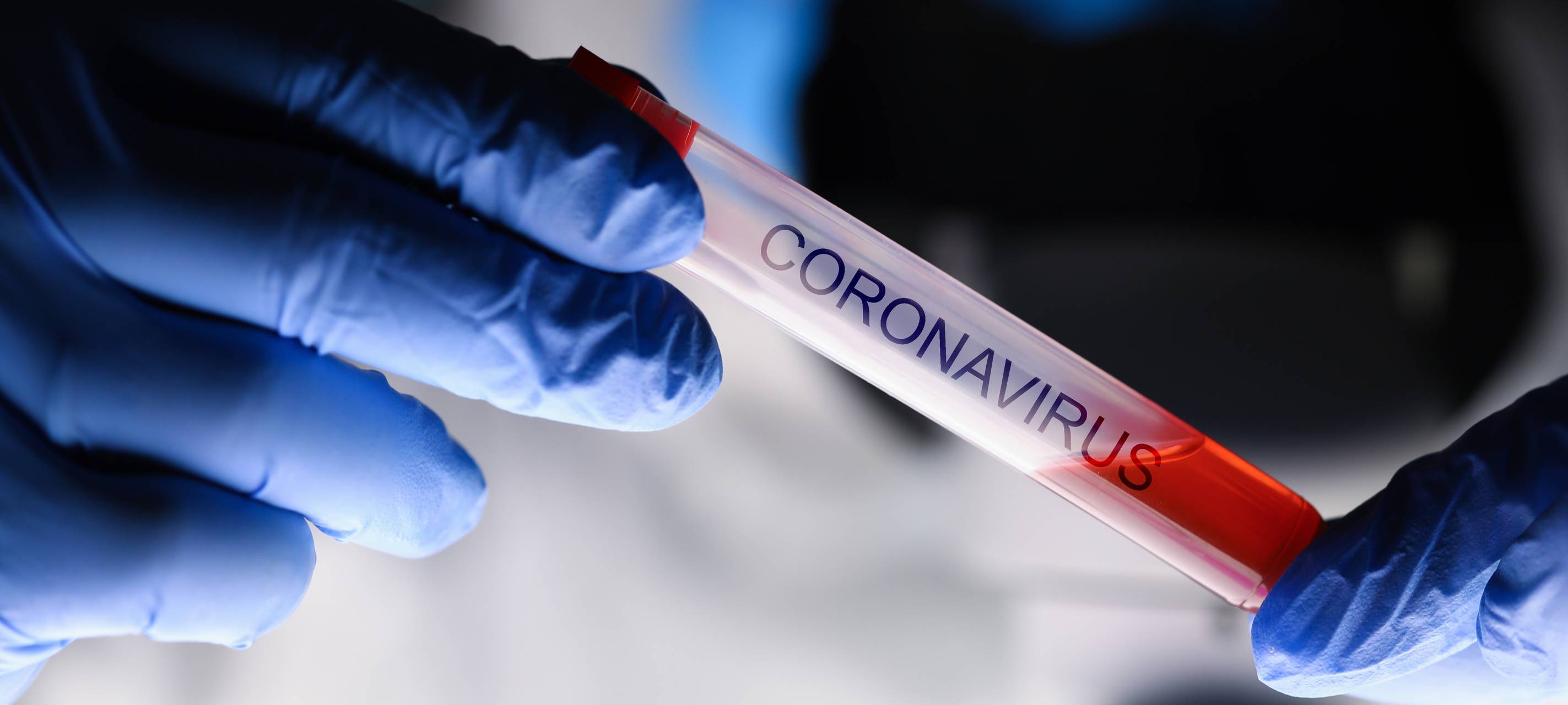 Zweites kommunales Abstrichzentrum