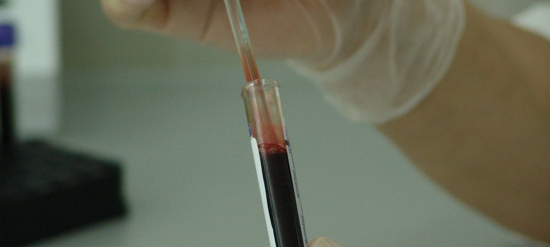 Vorbereitungen für Blutplasma-Therapie laufen