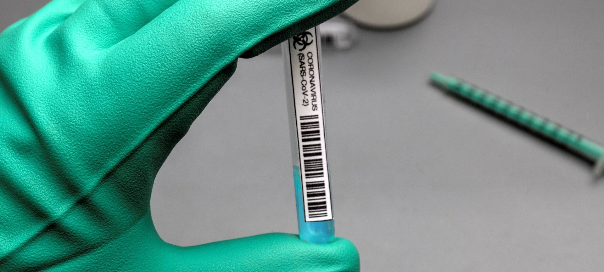 Regelmäßige Tests für Erzieher gefordert