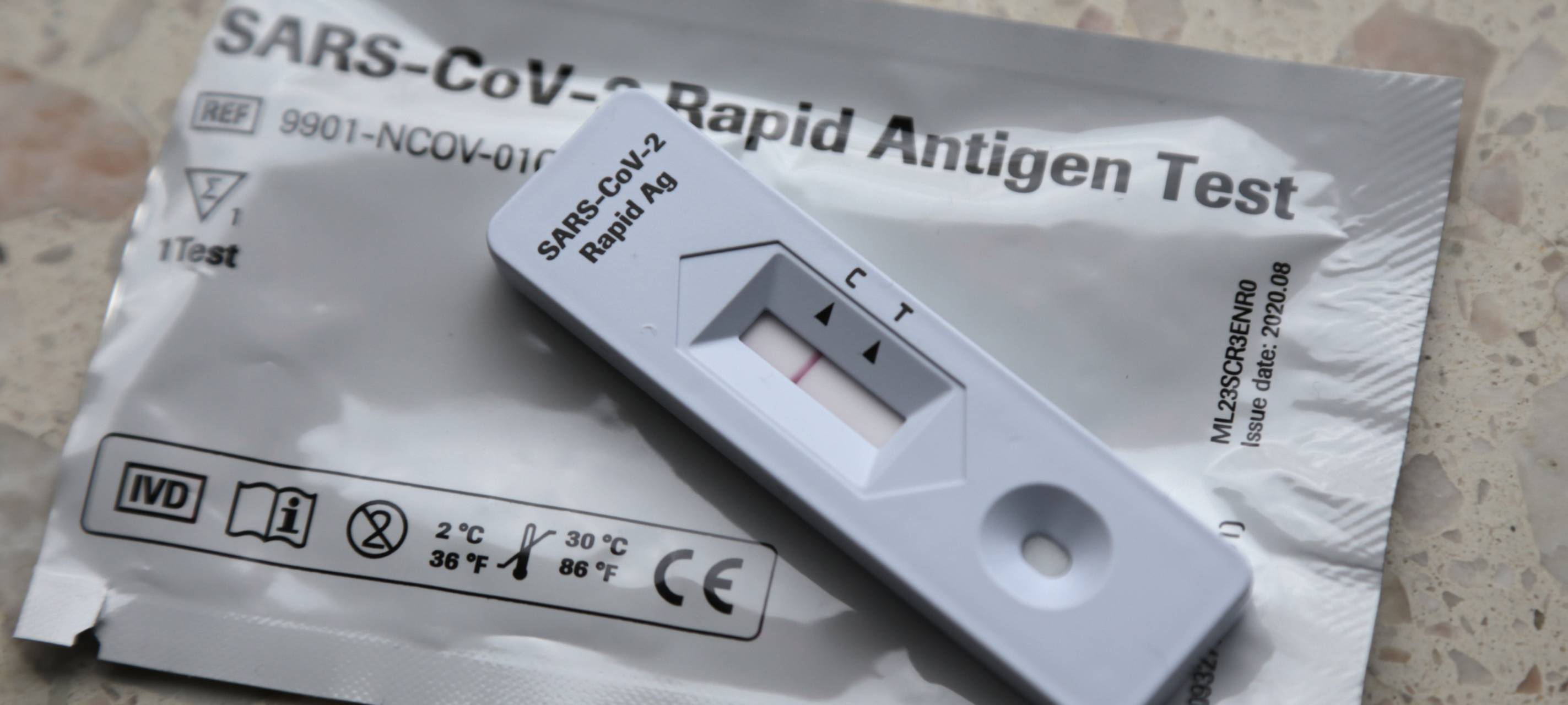 Chef kann Corona-Test bestätigen