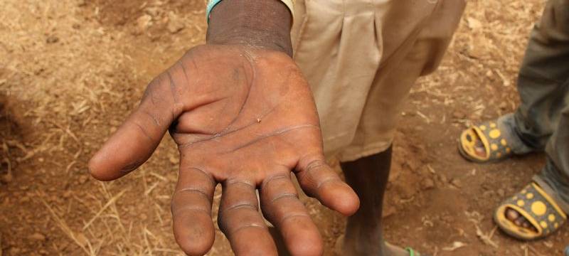 Sternsinger: Kinderarbeit nimmt weltweit wieder zu