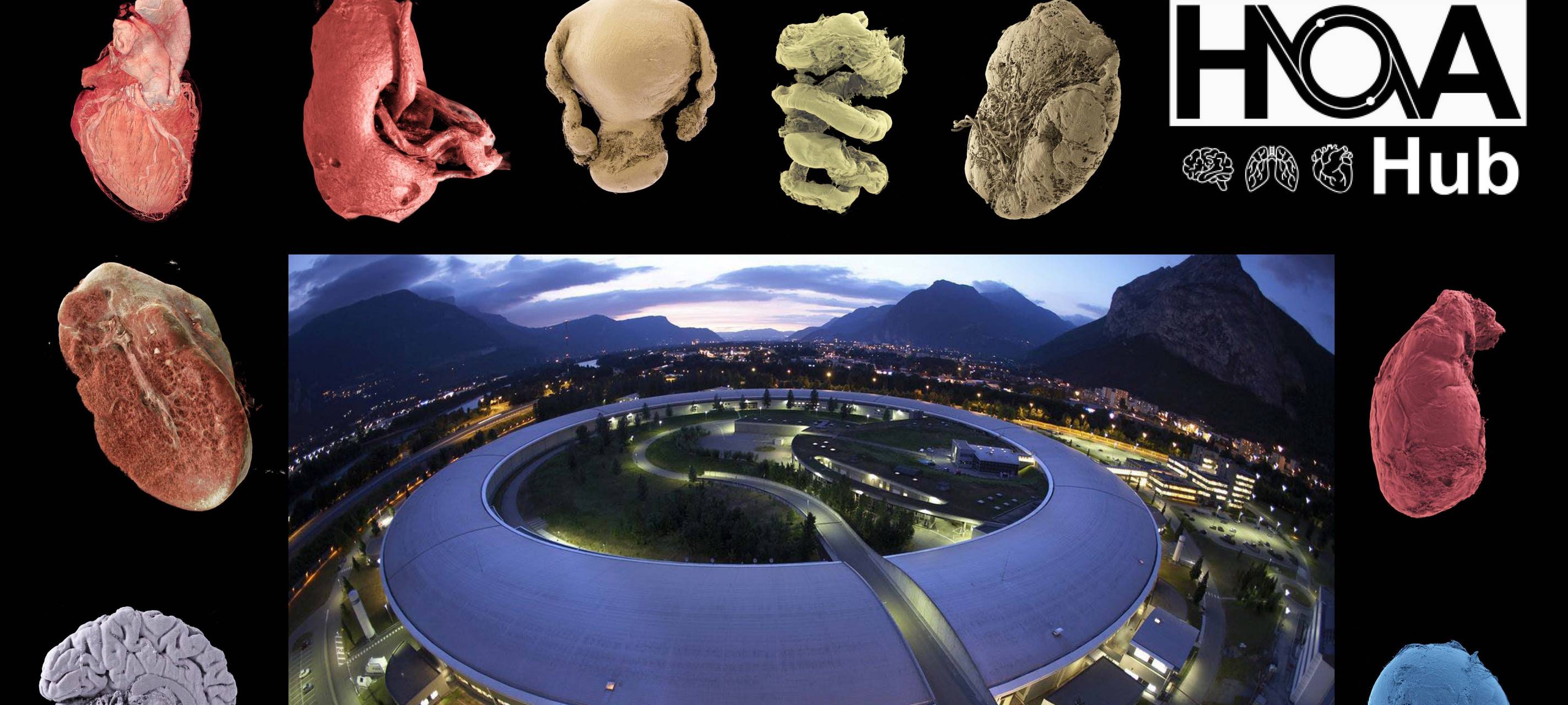 "Google Earth der Anatomie": Human Organ Atlas