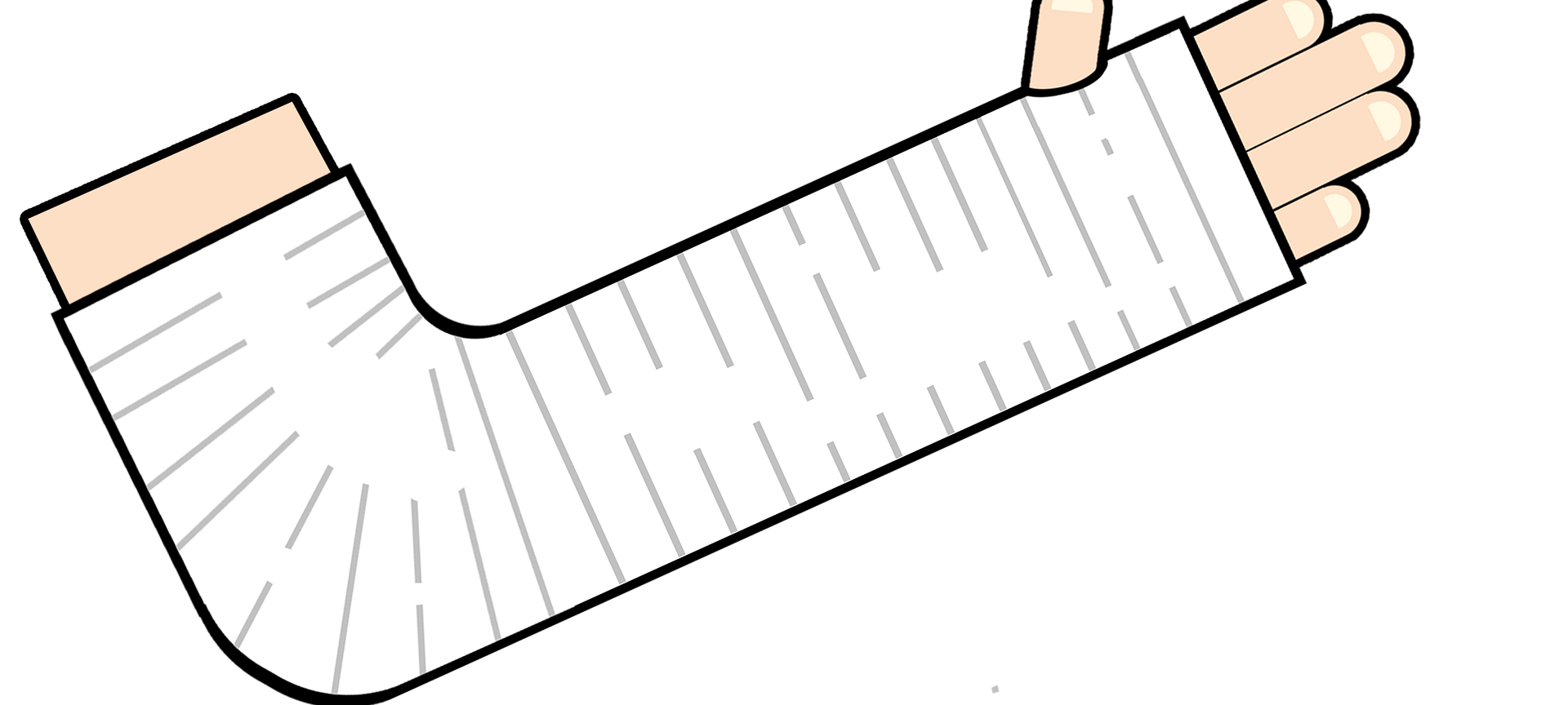 Kurioser Fall: Kein rechtlicher Schutz vor Vergesslichkeit